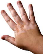 © Axel Bückert - Fotolia.com